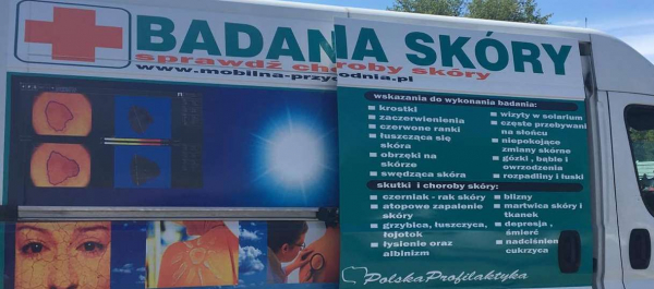 Diagnostyka znamion czas start! Bezpłatna dermatoskopia w Korycinie